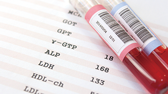 当院で出来る検査